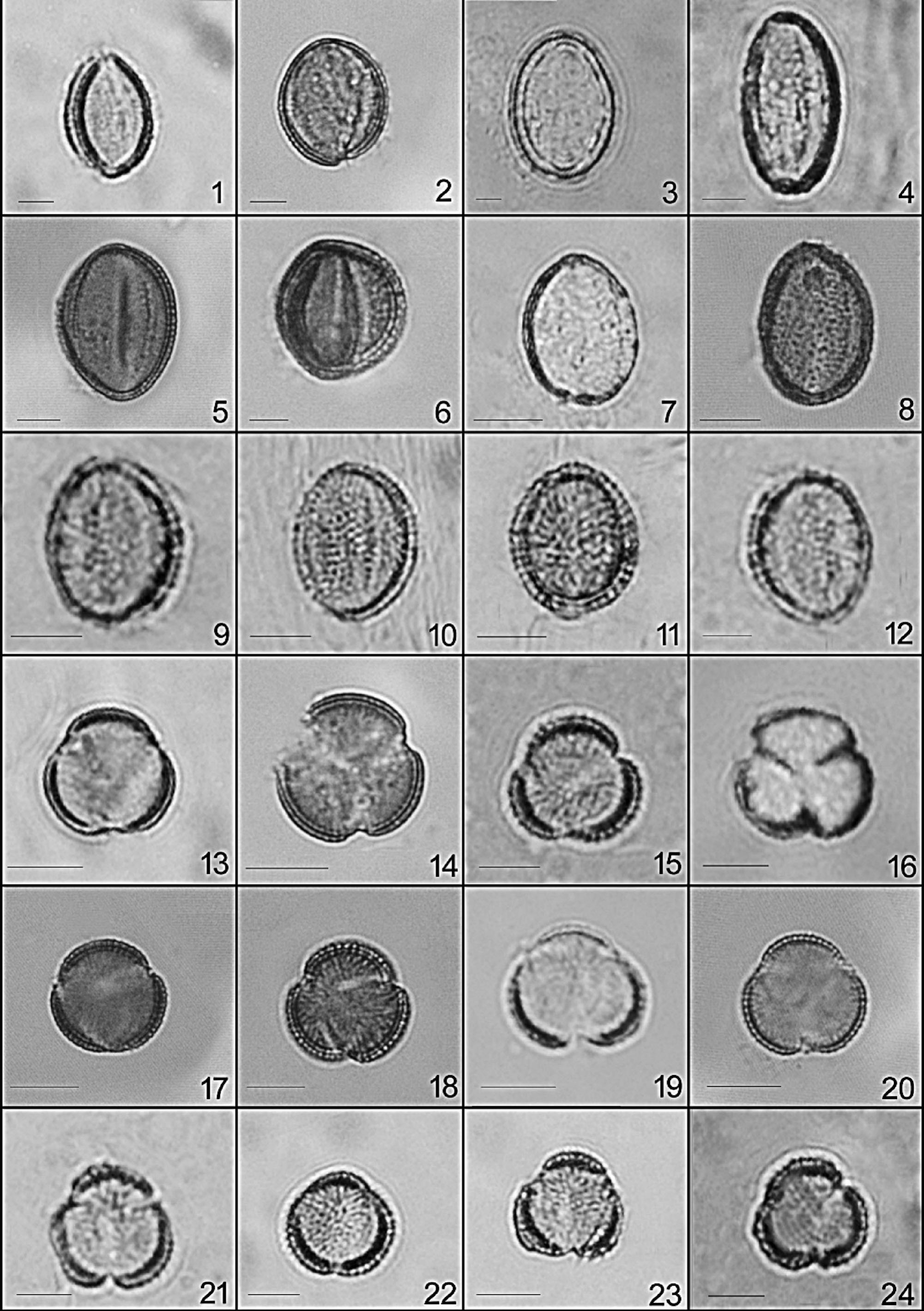 Pollen Morphology Of Some Selected Species Of The Tribes Brassiceae ...