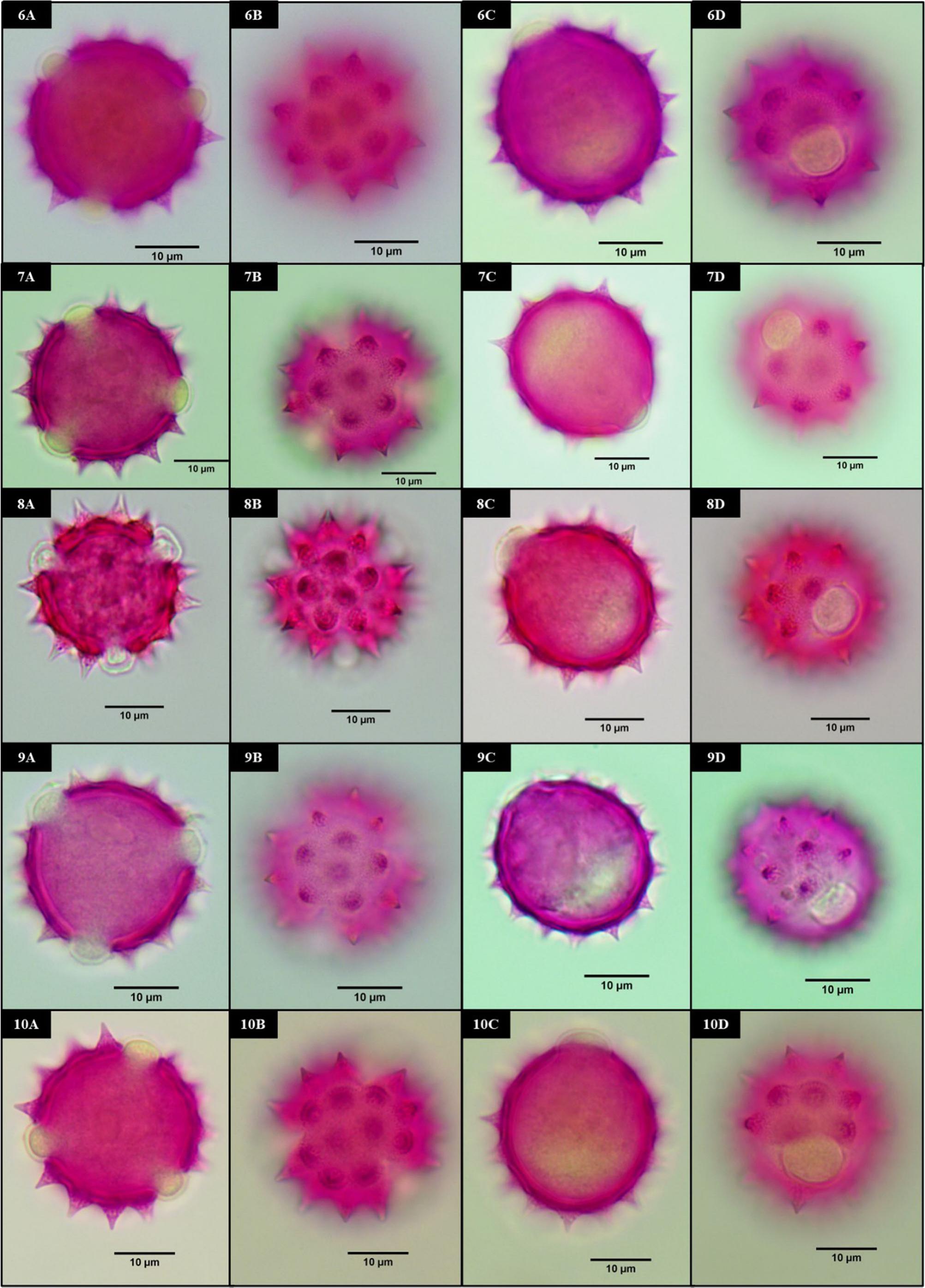 Pollen Morphology of Doronicum L. (Asteraceae: Senecioneae) from Turkey ...