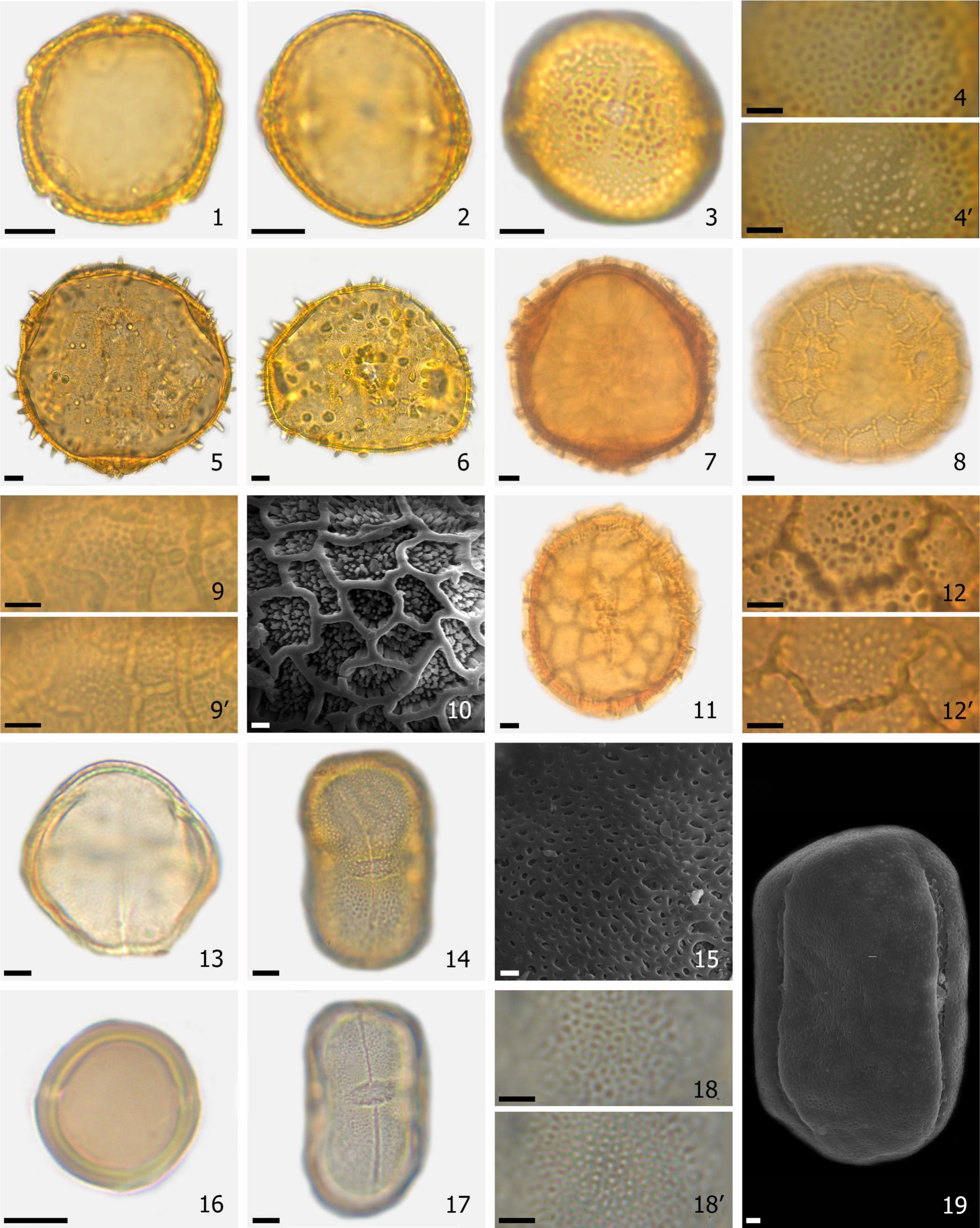 Pollen Morphology Characterization of Dryades Groppo, Kallunki & Pirani ...