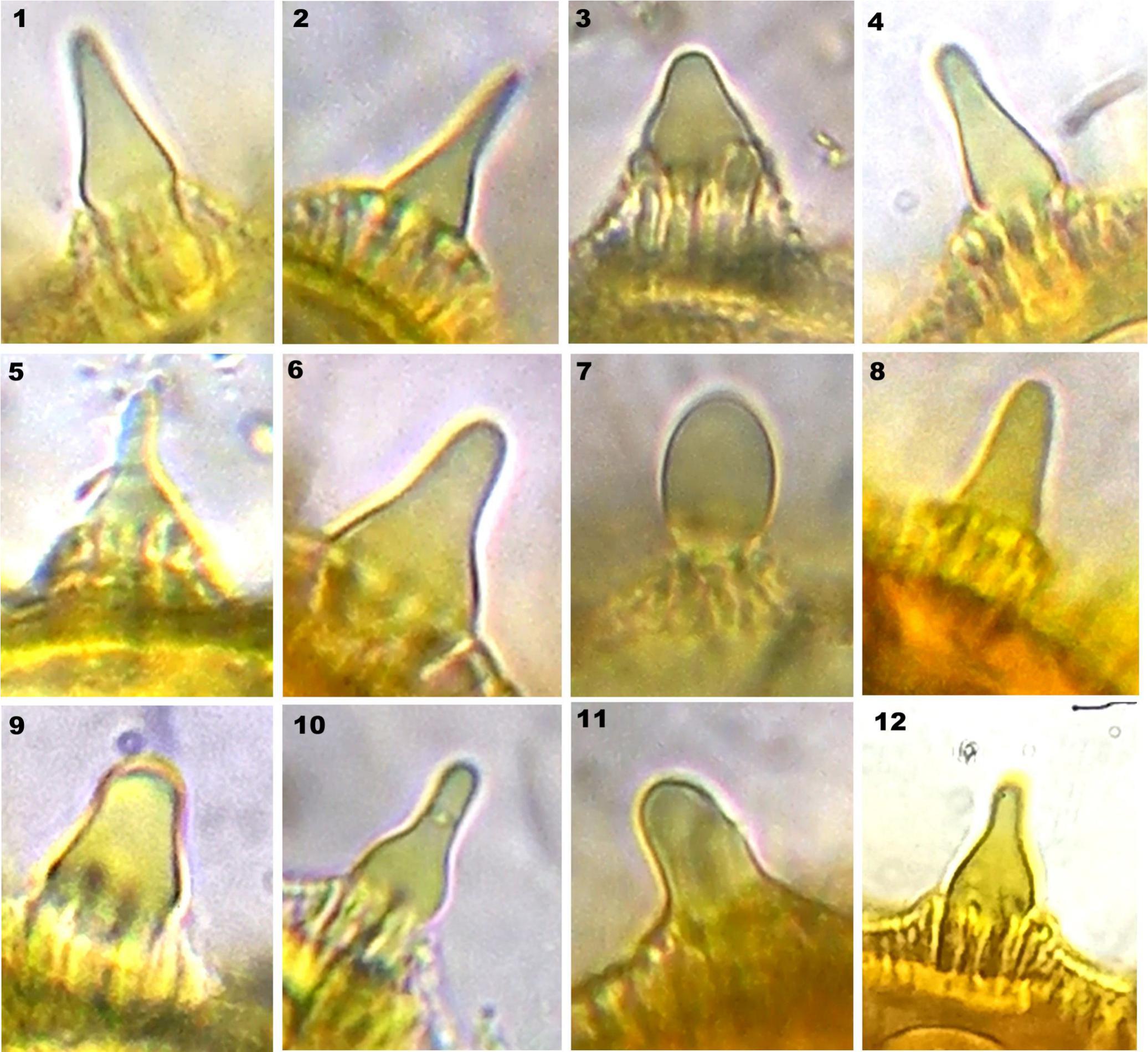 Pollen Morphology of Ipomoea L. from Garhwal Himalaya, India