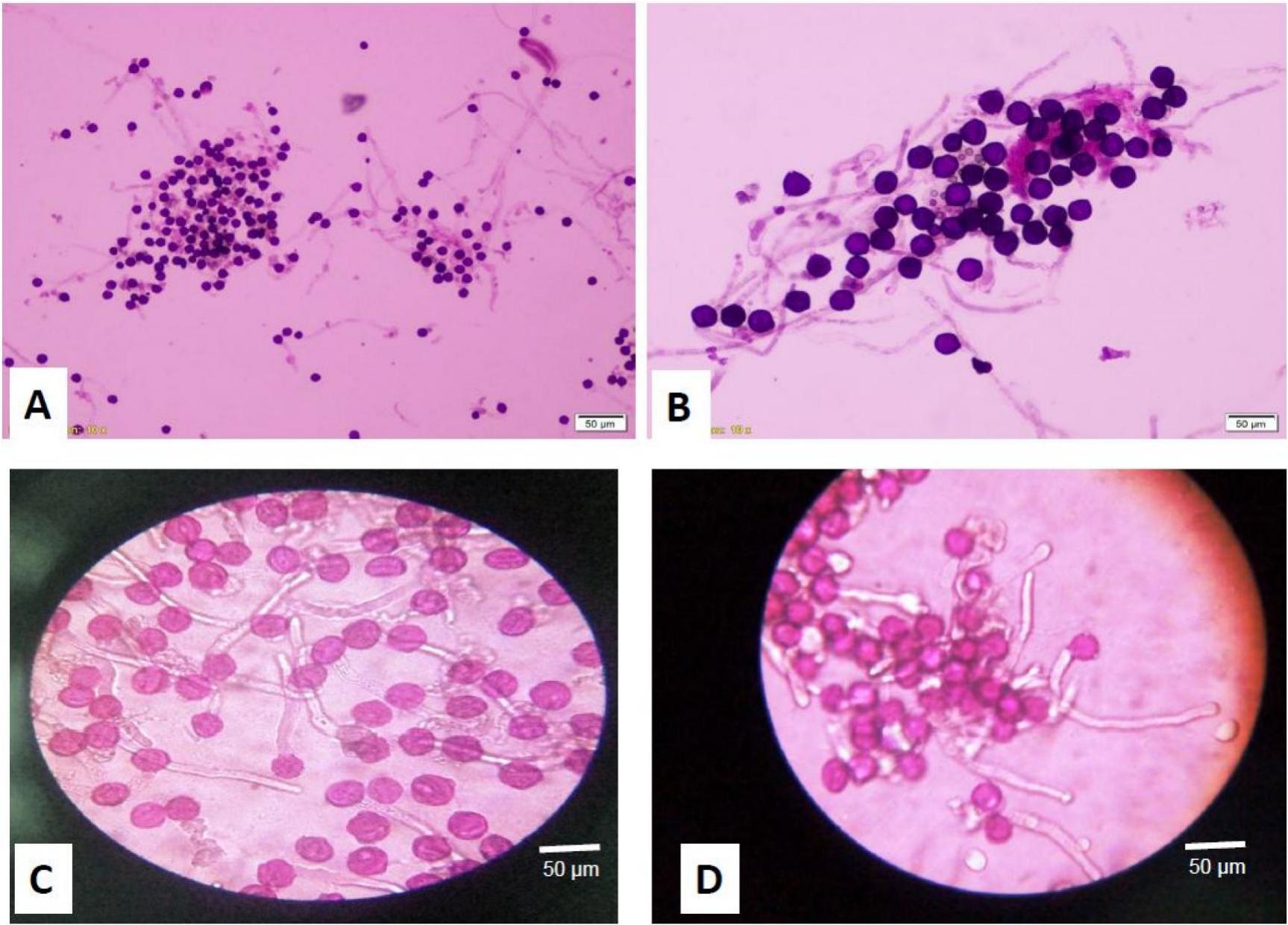 Optimizing In vitro Pollen Viability and Cryopreservation Protocols ...
