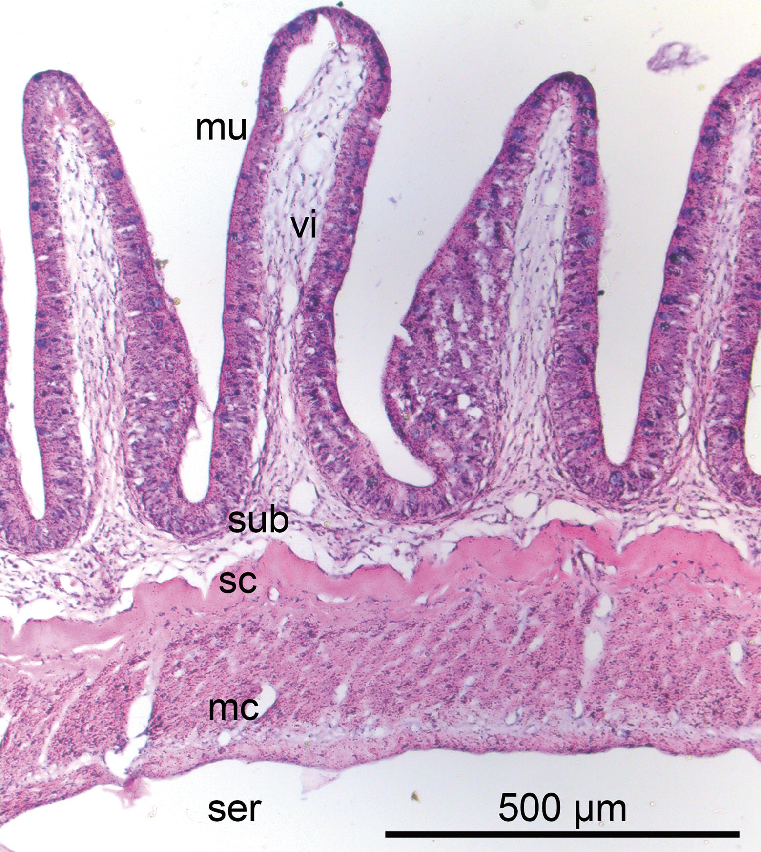 Histopathology of Catostomus commersoni (White Sucker) Infected with ...