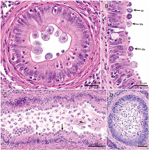 Newly Described Coccidia Goussia bayae from White Perch Morone ...