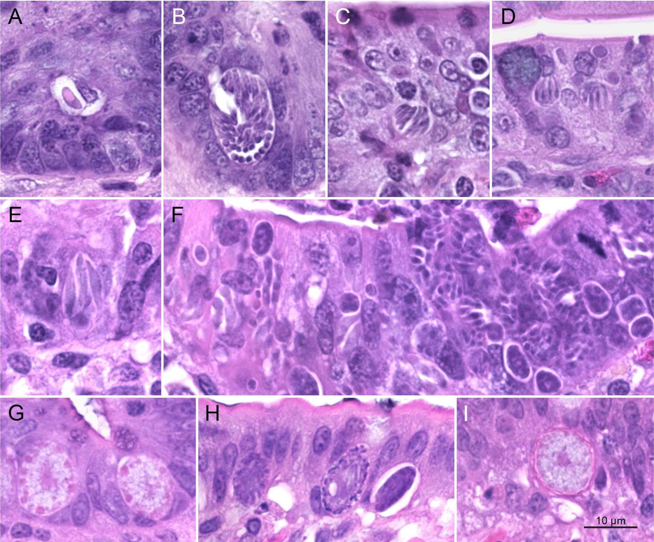 Description of a New Eimeria Species (Apicomplexa: Eimeriidae) Responsible  for Clinical Coccidiosis in Commercial Chukar Partridge (Alectoris chukar)