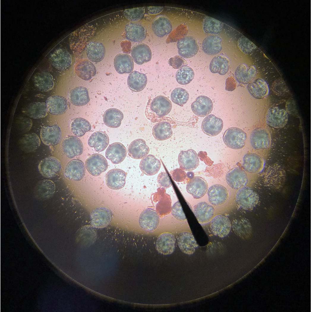 Scolicidal Potency of Bile Against Echinococcus granulosus