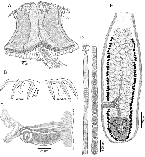 Sisters Parasitizing Sisters: On the Onchobothriidean Tapeworms of