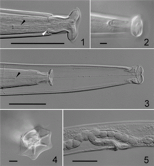STRELKOVIMERMIS PAPILLOSUS N. SP. (NEMATODA: MERMITHIDAE), A PARASITE ...