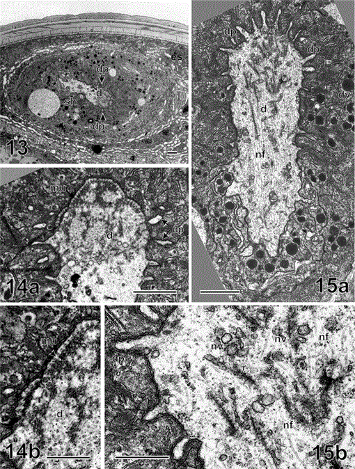 PHASMID ULTRASTRUCTURE OF AN ASCARIDOID NEMATODE HYSTEROTHYLACIUM AUCTUM