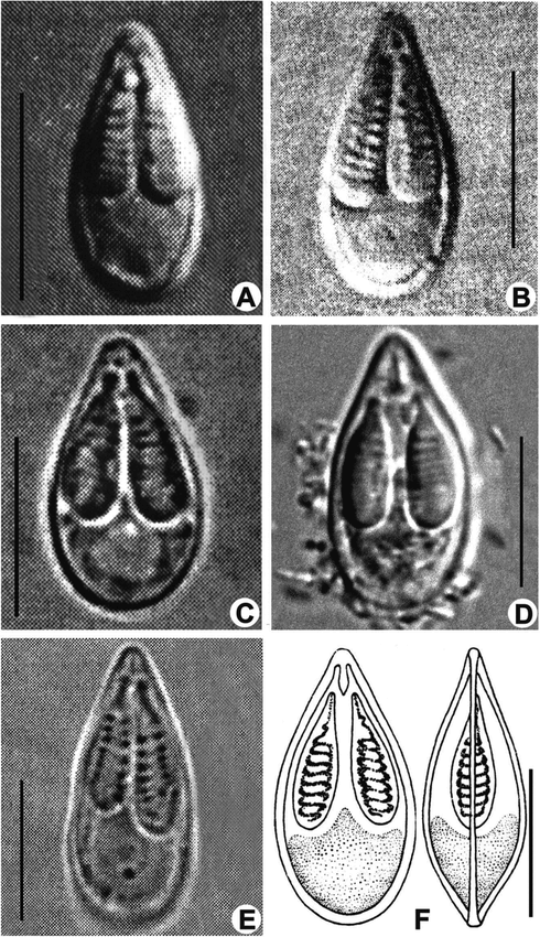 Description Of A New Species Of Myxobolus (Myxozoa: Myxobolidae) Based ...