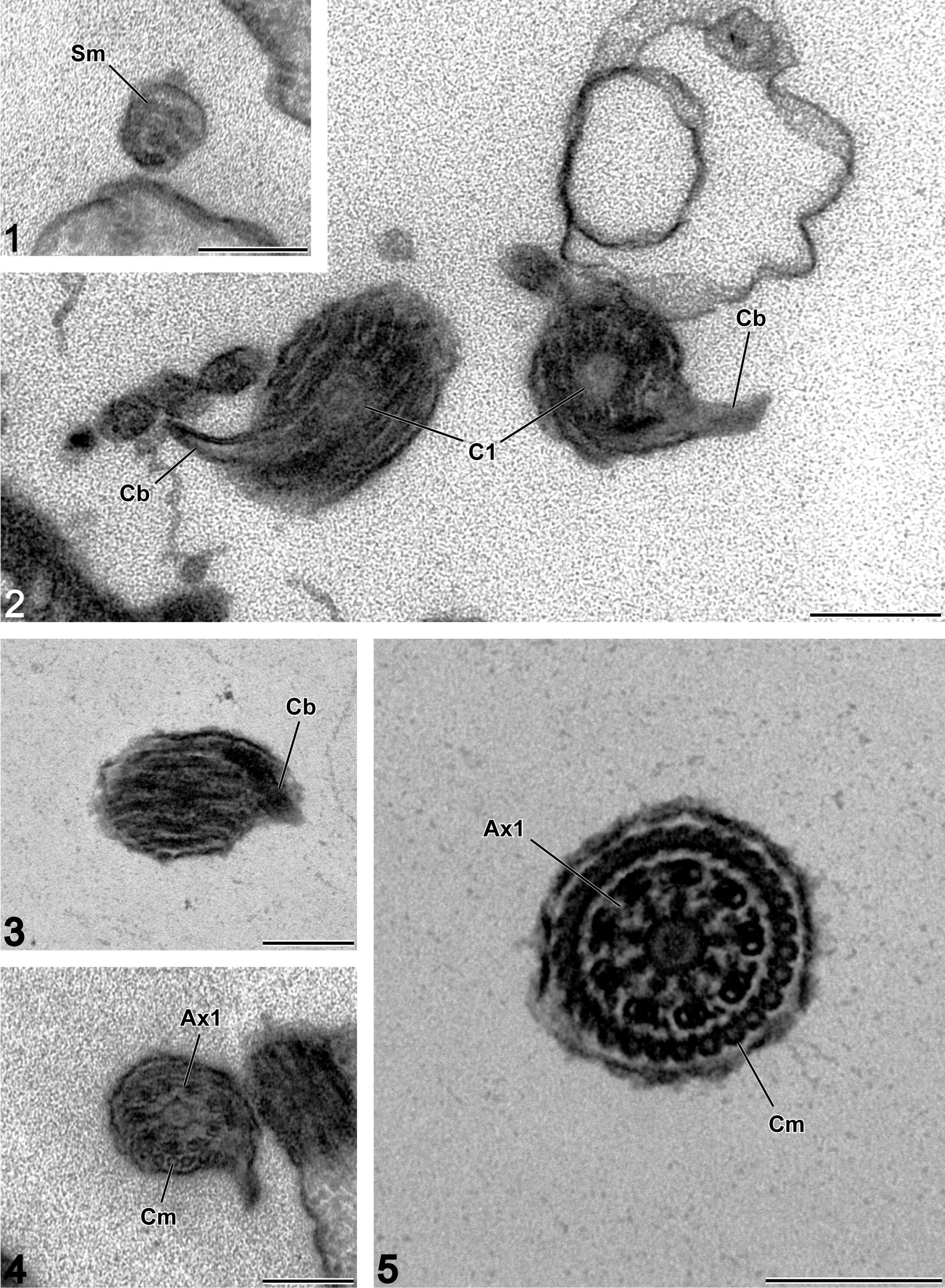 Ultrastructure of the Spermatozoon of Bothriocotyle SP. (Cestoda ...