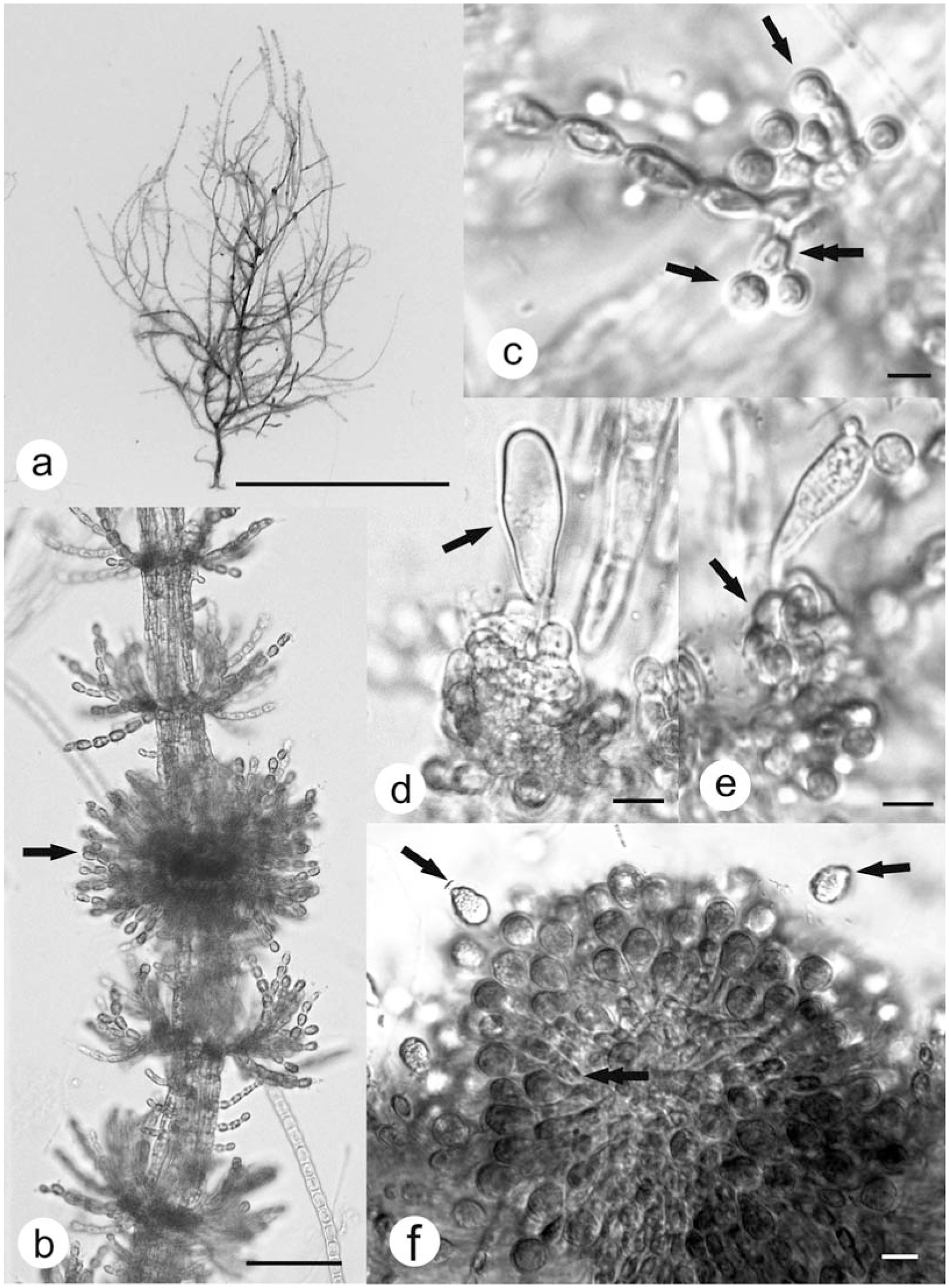 A New Species of Kumanoa (Batrachospermales, Rhodophyta) from Kōke‘e ...