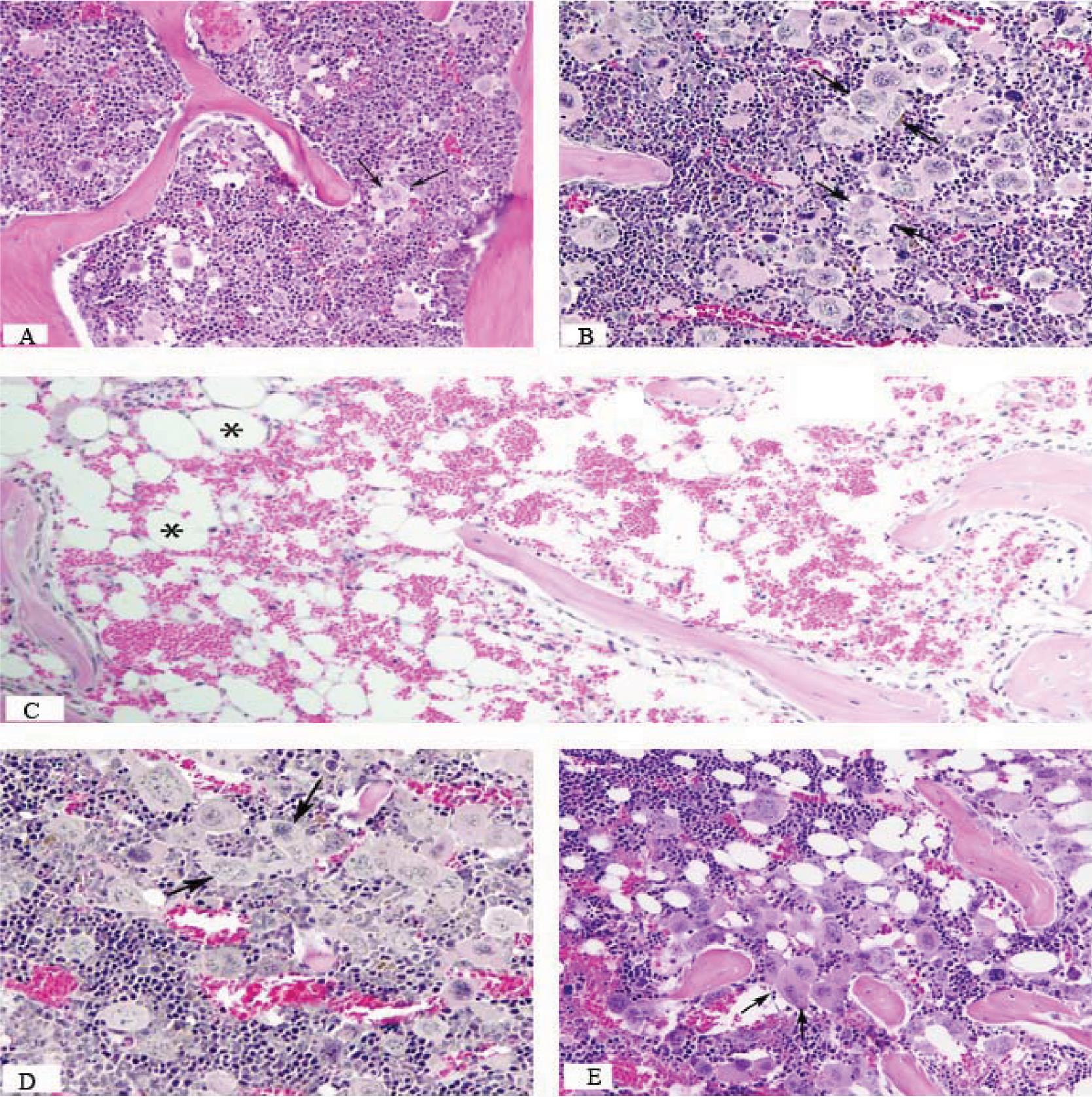 A TPO Receptor Agonist, ALXN4100TPO, Mitigates Radiation-Induced ...