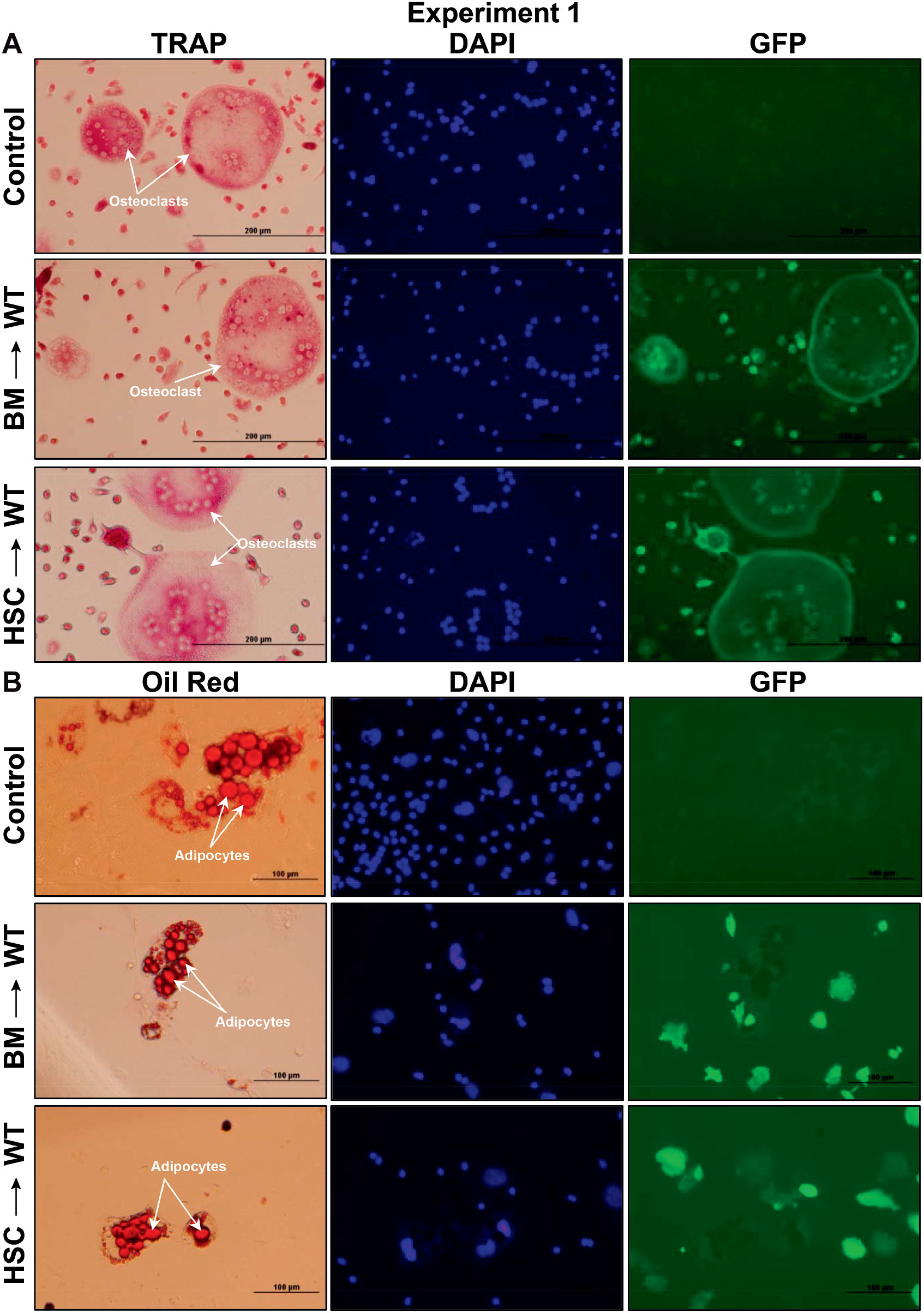 ... Maintenance Bone Near and of Mass Architecture Normal in