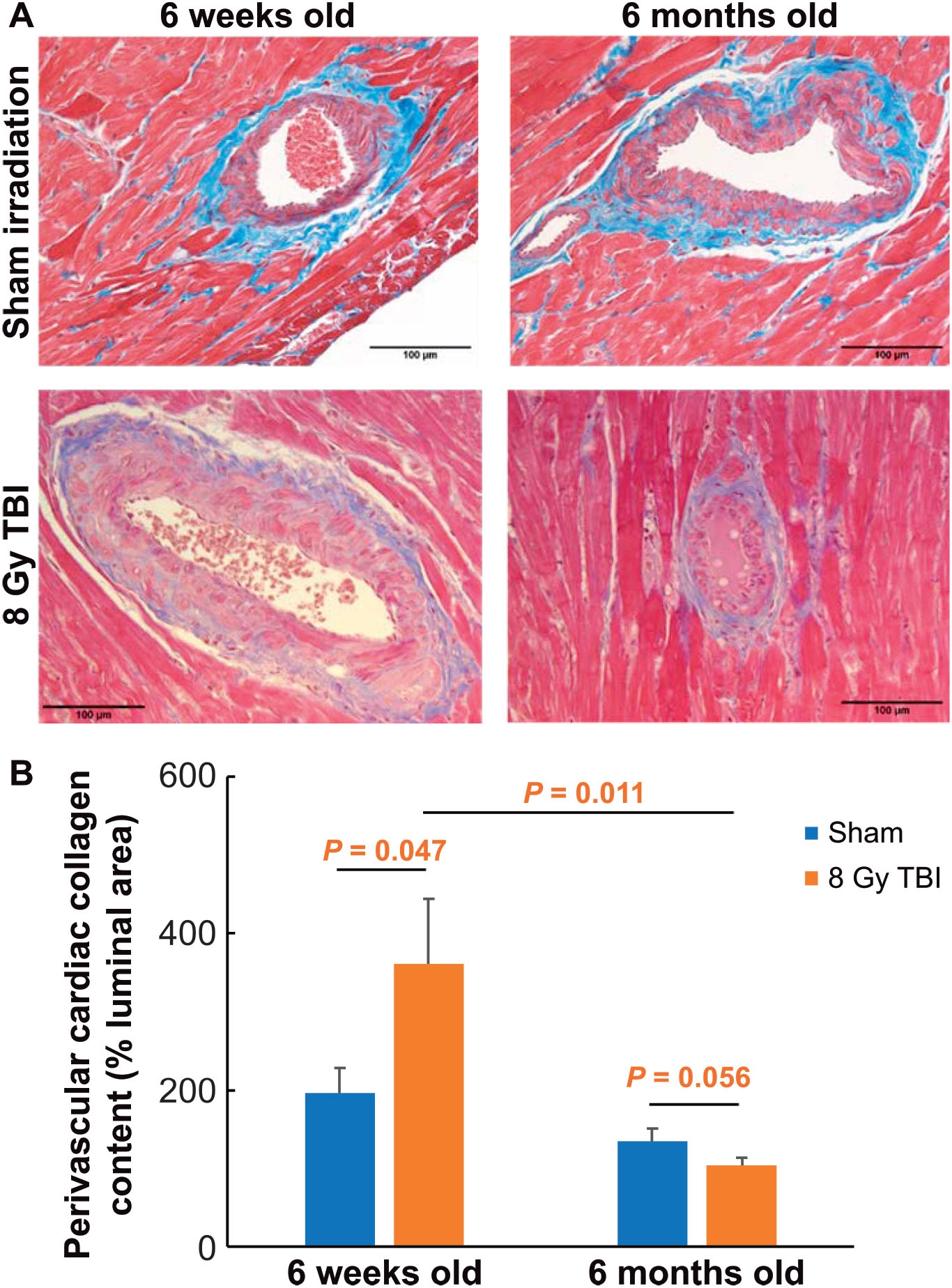 Age At Exposure To Radiation Determines Severity Of Renal And Cardiac Disease In Rats