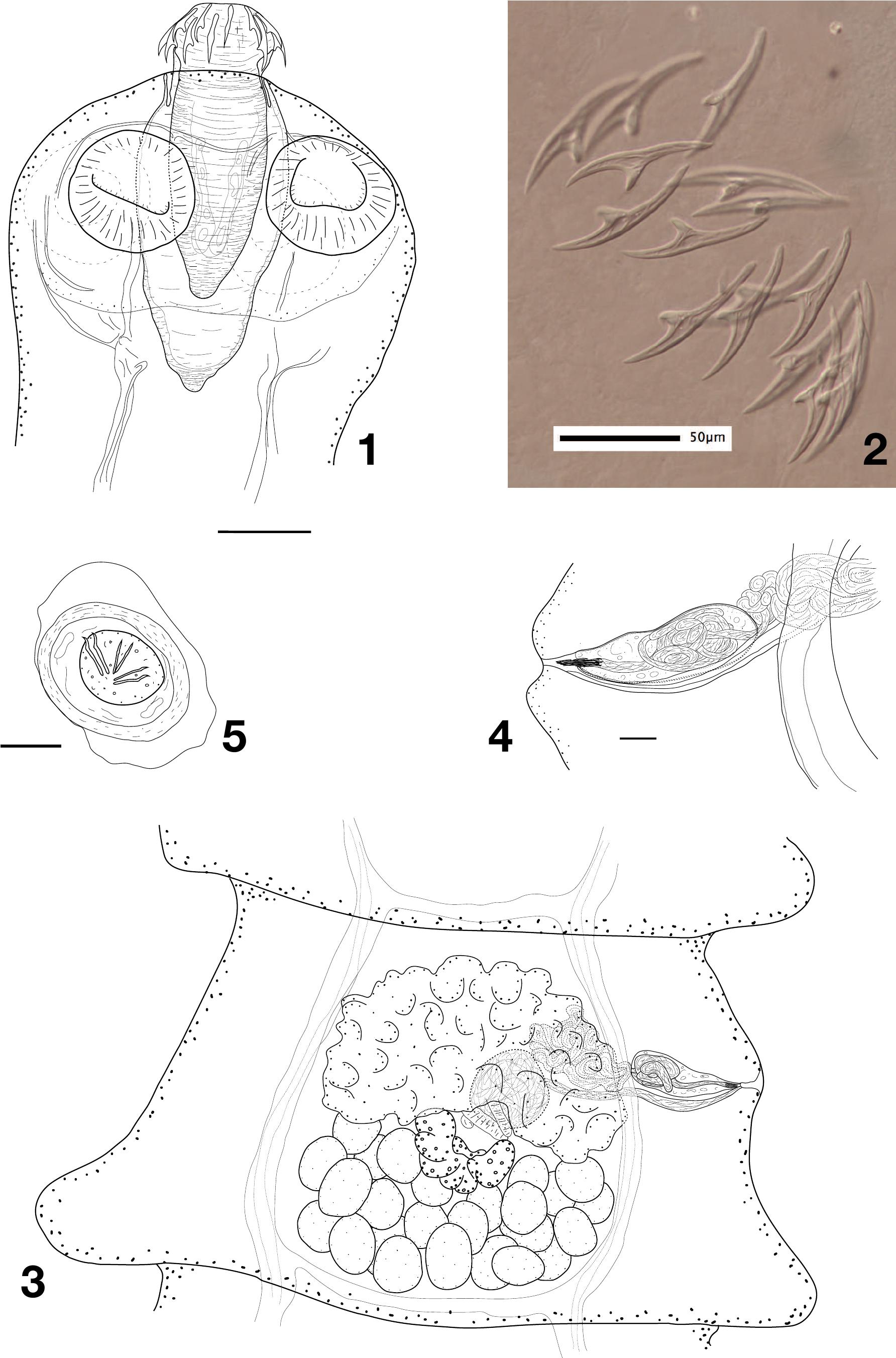Two new species of Cestoda (Cyclophyllidea: Dilepididae) from Ploceidae ...