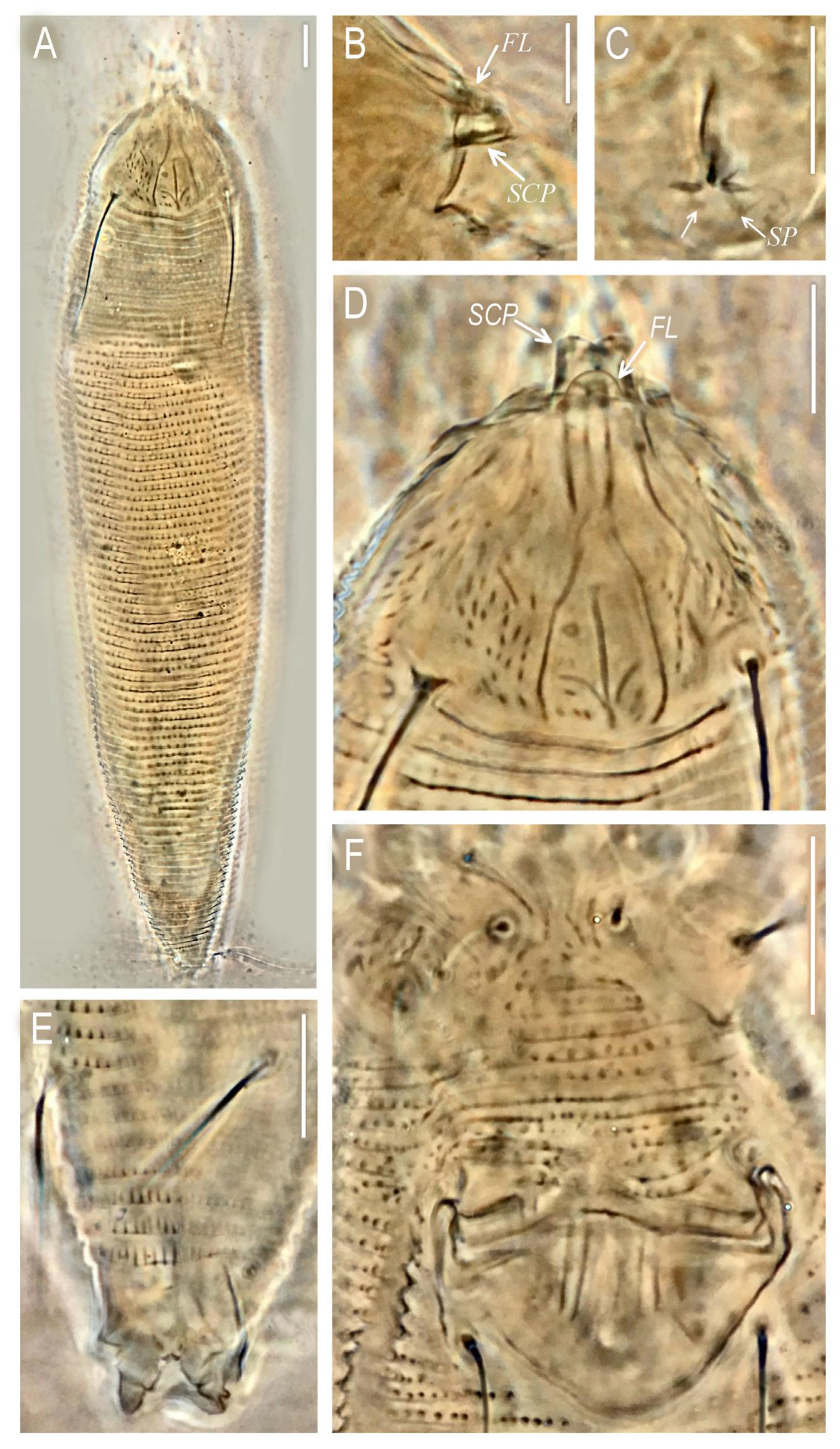 Description Of Aculops Shalchii Sp Nov And Supplementary Descriptions Of Eriophyes Euphorbiae And Aceria Rubiae Trombidiformes Eriophyoidea Eriophyidae From Iran