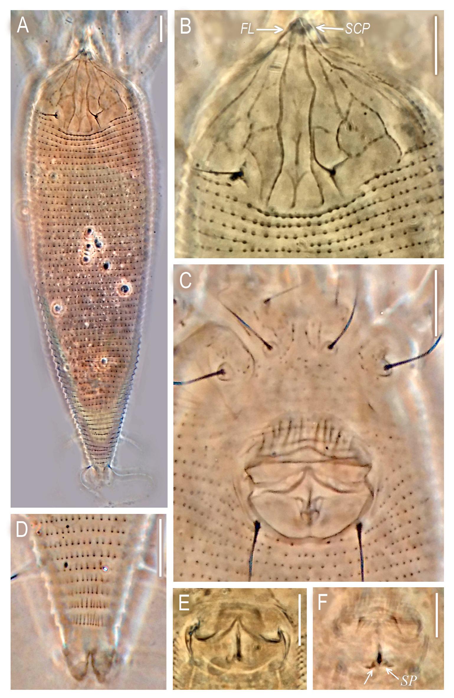 Description Of Aculops Shalchii Sp Nov And Supplementary Descriptions Of Eriophyes Euphorbiae And Aceria Rubiae Trombidiformes Eriophyoidea Eriophyidae From Iran