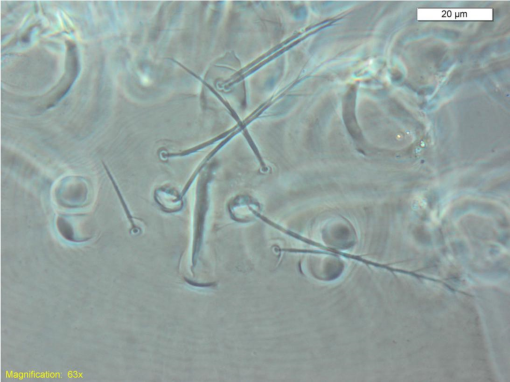 Two new larval species of Birjandtrombella (Neotrombidiidae) from