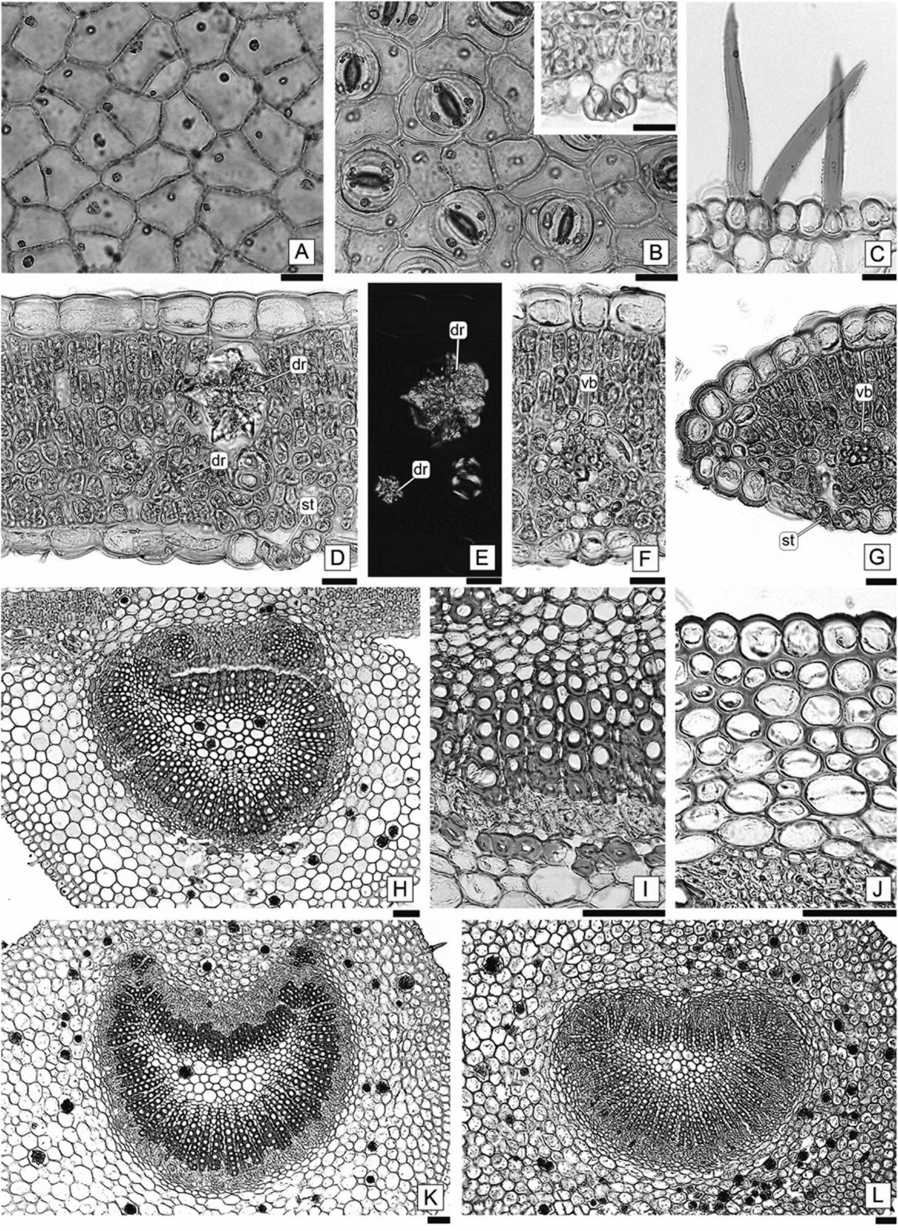 A New Species Of Randia Rubiaceae And The Taxonomic Significance Of Foliar Anatomy In The Species Of Randia Of The Southern Cone Of America