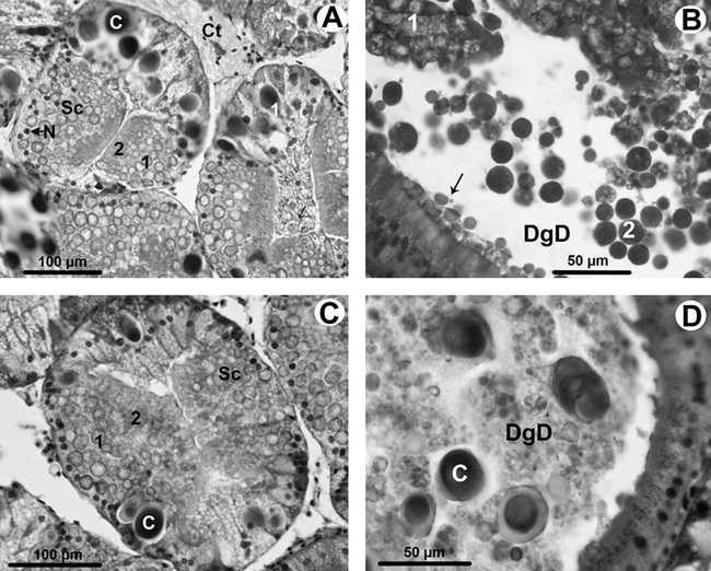 COCCIDIAN (APICOMPLEXA) PARASITE INFECTING STROMBUS GIGAS LINNÉ, 1758 ...