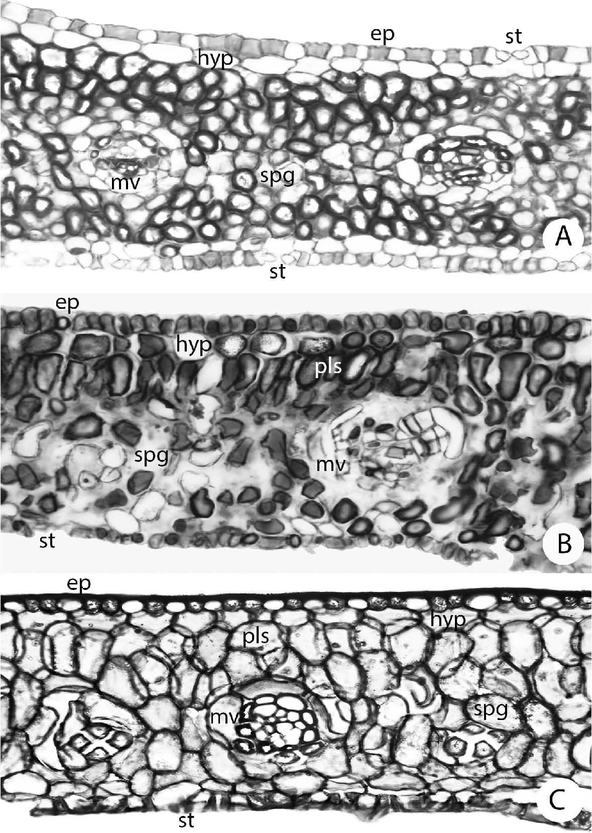 Leaf anatomy of the genus Leopoldinia (Arecaceae)