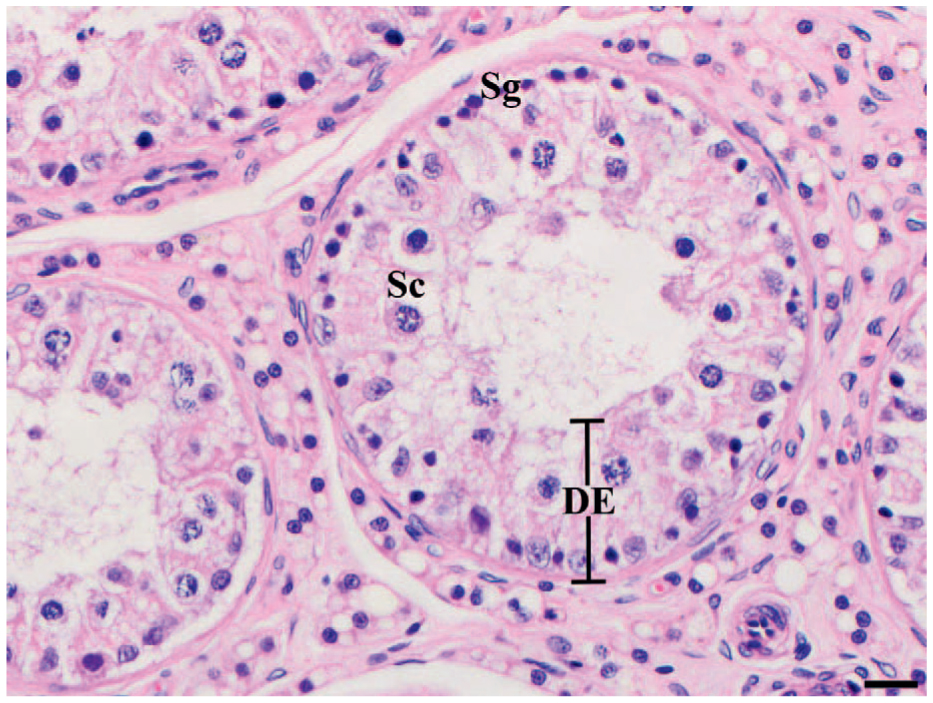 Testicular activity and epididymal sperm collection from American black ...