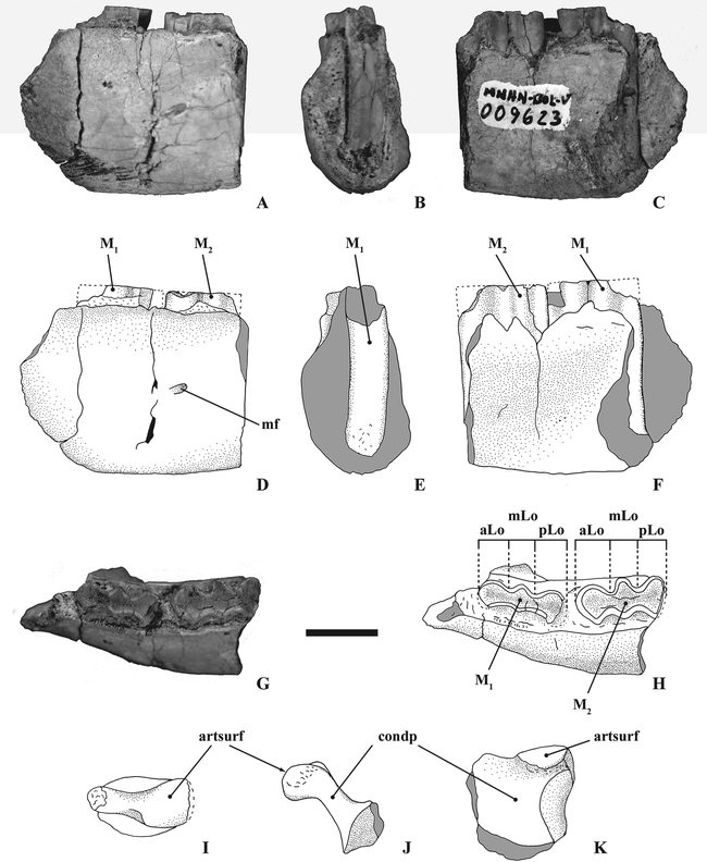 Poliartrita reumatoida