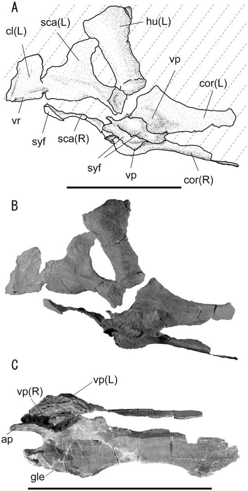 Common underlays included anterior base wedges and sacral cutouts