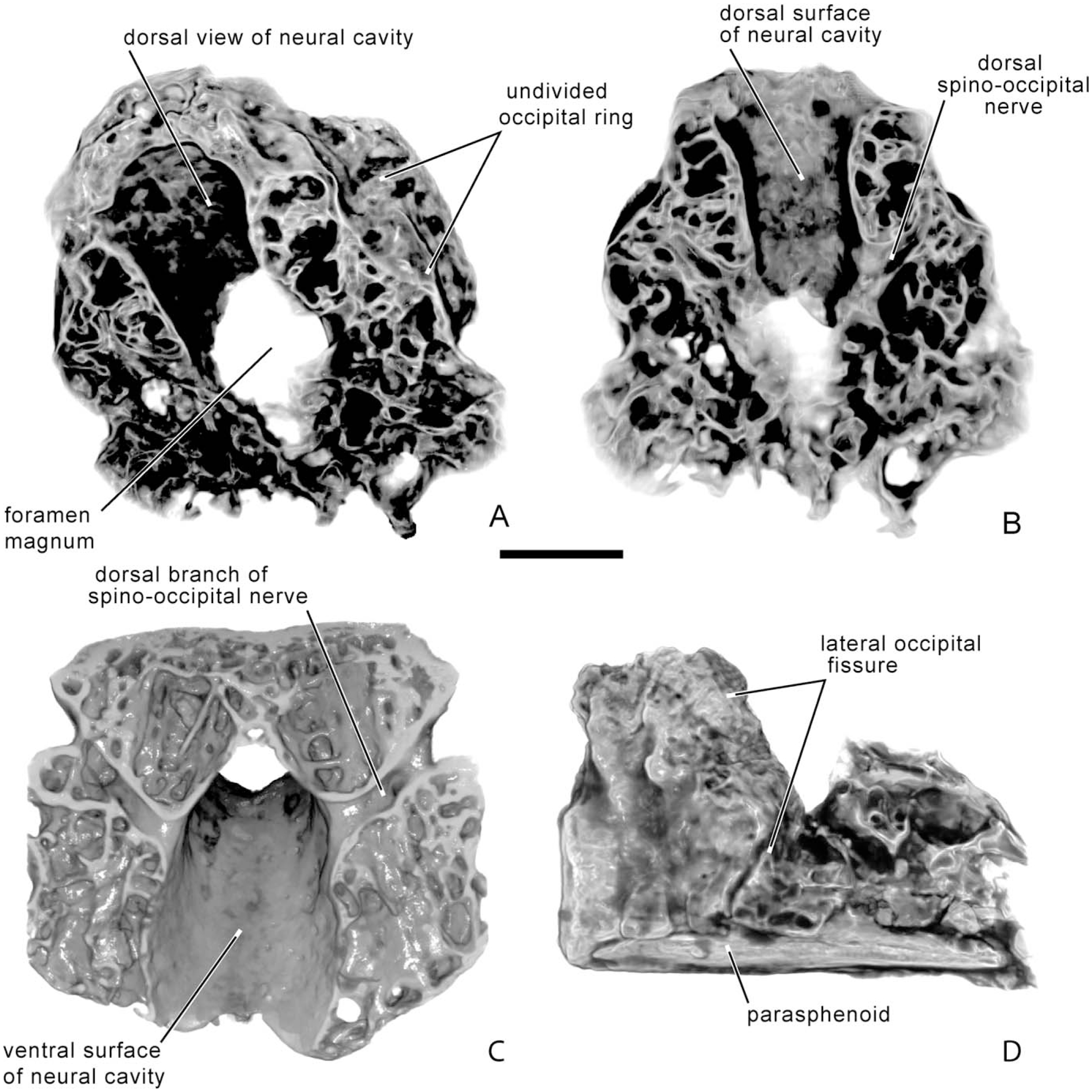 Floor Of Cranial Cavity