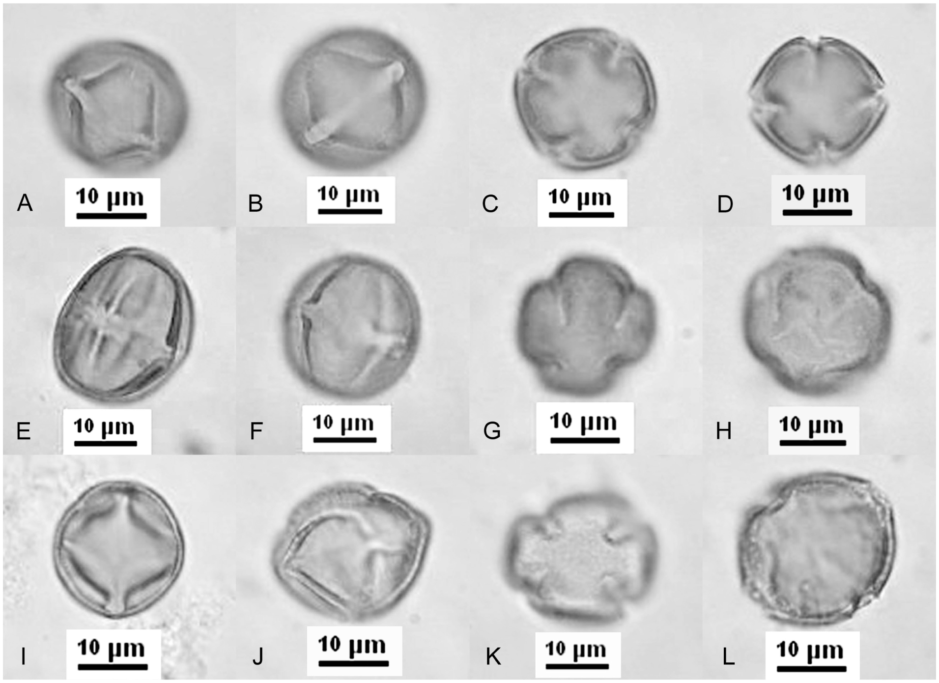Pollen Morphology Of The Southern African Tribe Teedieae An Early Branching Lineage Of Crown Scrophulariaceae
