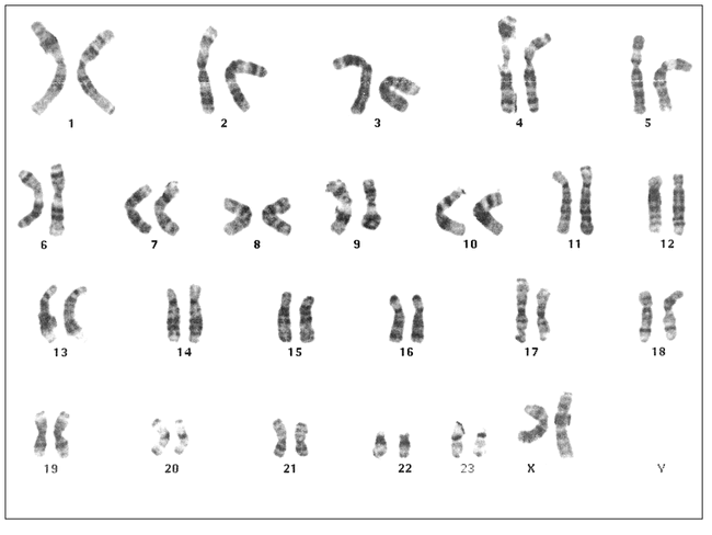 CHORIONIC VILLUS SAMPLING FOR SEX DETERMINATION IN A WESTERN LOWLAND ...