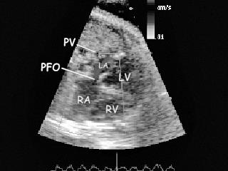 Fetal Echocardiographic Evaluation of the Bottlenose Dolphin (Tursiops ...