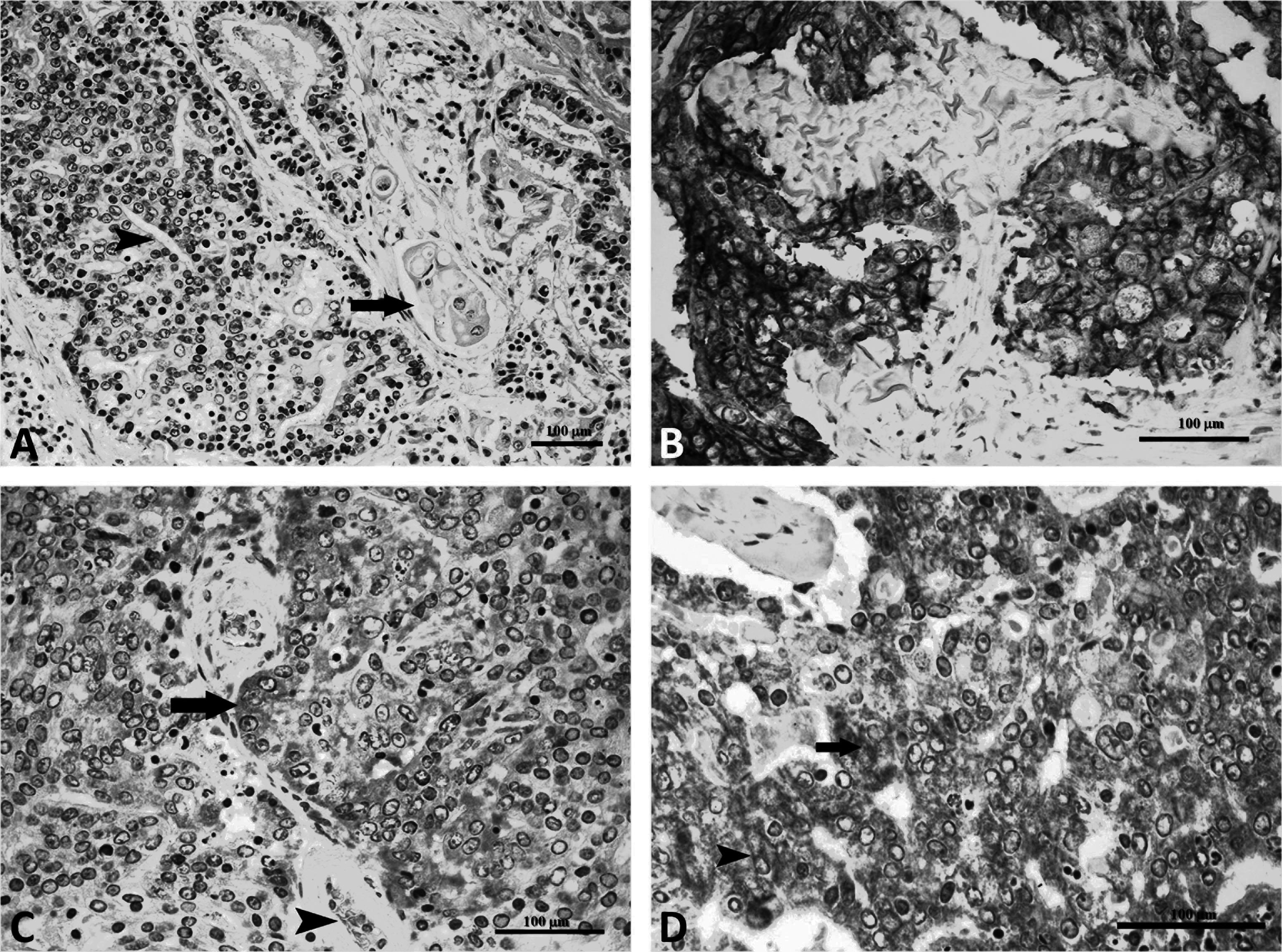 Mammary Carcinoma in a Tiger (Panthera tigris): Morphological and ...