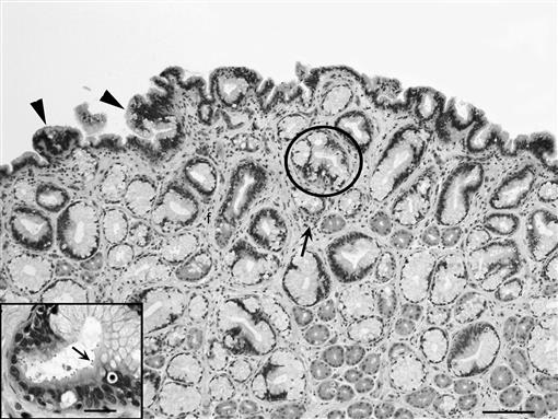 EVALUATION OF GASTROSCOPIC BIOPSY FOR DIAGNOSIS OF CRYPTOSPORIDIUM SP ...