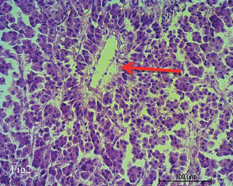 A RARE CASE OF HEPATOCELLULAR CARCINOMA IN THE ARABIAN SAND CAT (FELIS ...