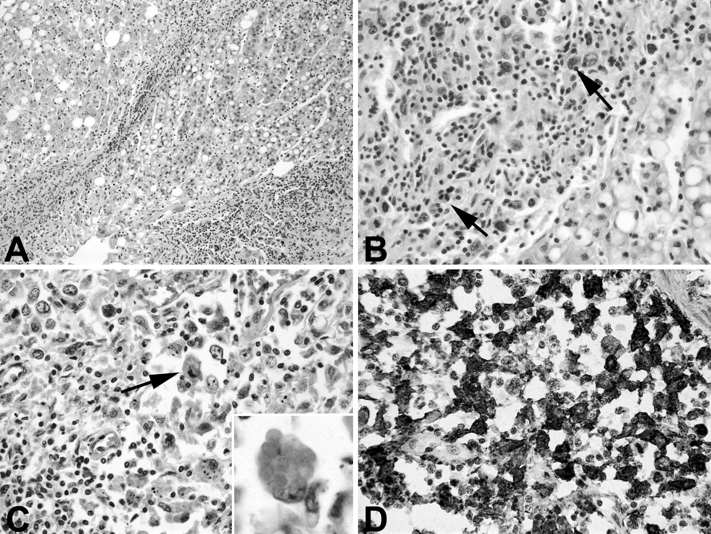 SYSTEMIC HISTIOCYTIC SARCOMA IN A COMMON HIPPOPOTAMUS (HIPPOPOTAMUS ...