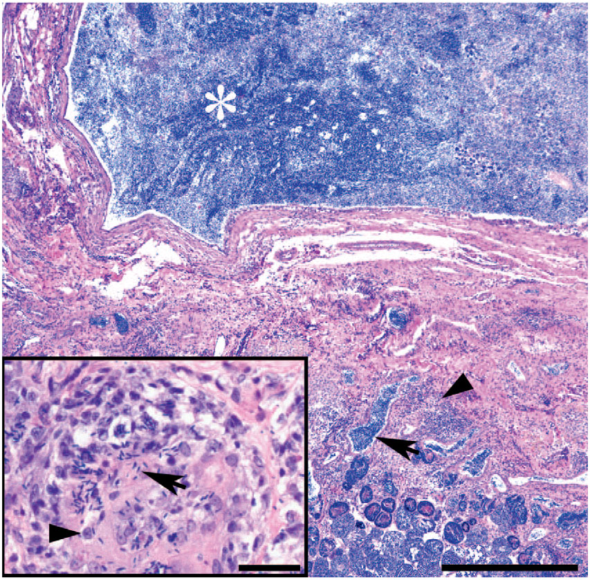 CLINICAL CHALLENGE: A SPERMATOCELE AND SPERM GRANULOMAS IN A FOUR-EYED ...