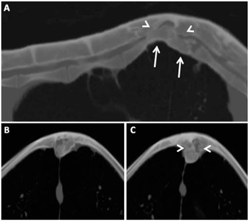 osirix md torrent