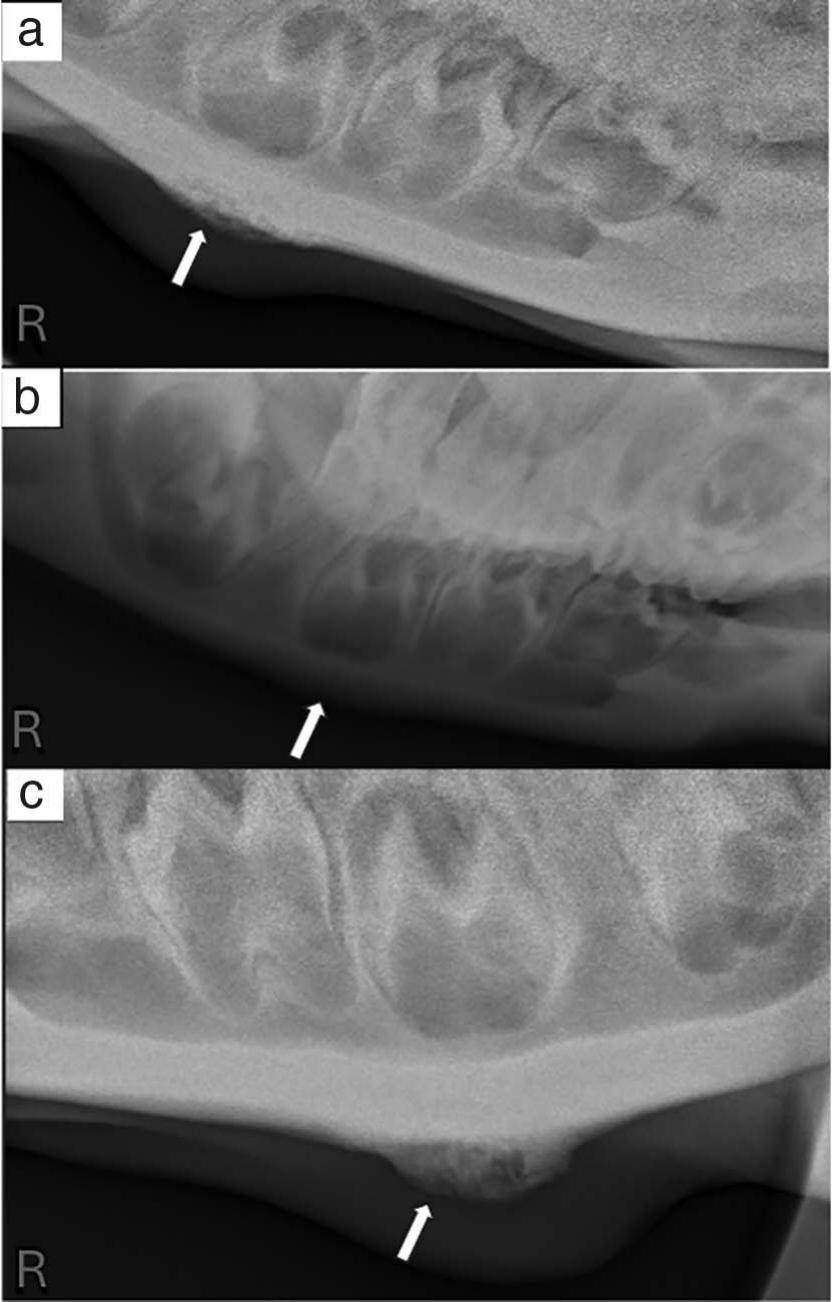 BENIGN OSSEOUS PROLIFERATIONS OF THE VENTRAL MANDIBLE IN TWO MALAYAN ...