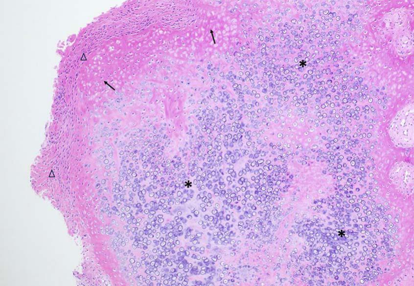 BENIGN OSSEOUS PROLIFERATIONS OF THE VENTRAL MANDIBLE IN TWO MALAYAN ...