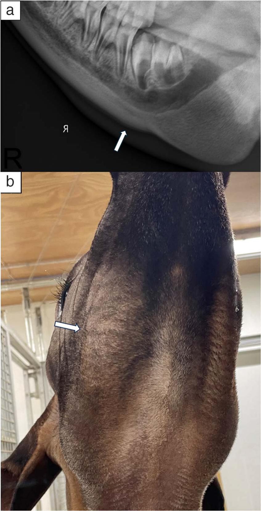 BENIGN OSSEOUS PROLIFERATIONS OF THE VENTRAL MANDIBLE IN TWO MALAYAN ...