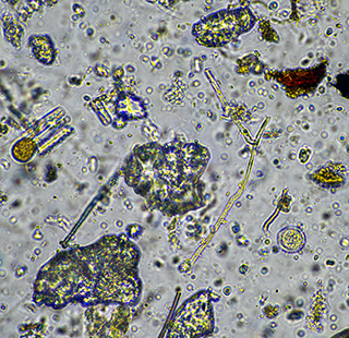 fungal hyphae and soil fungi in a soil sample viewed with a microscope